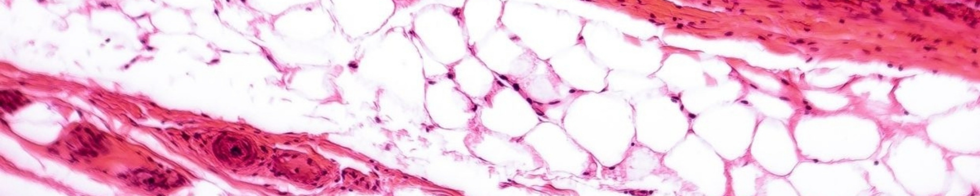 Collagen for wrinkles Why is collagen important?