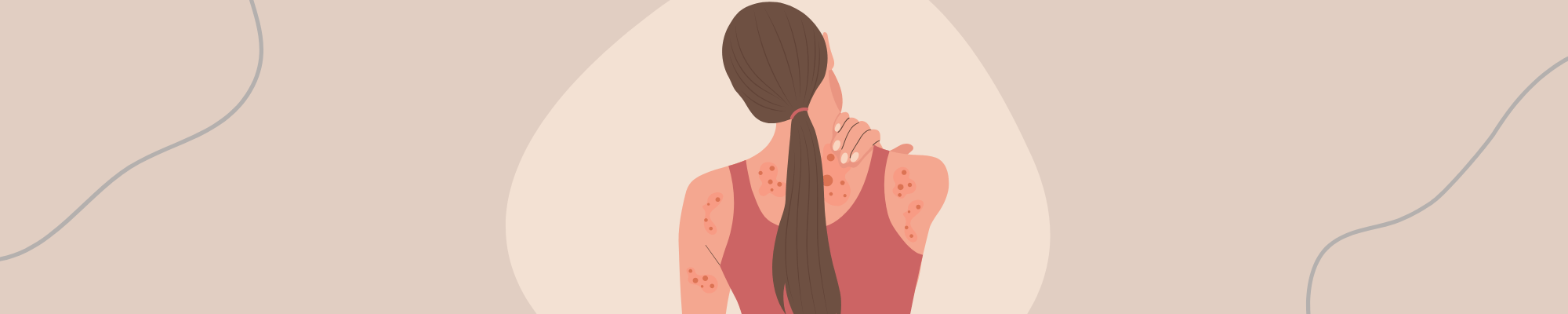 Ursache von Schuppenflechte Wie entsteht Psoriasis