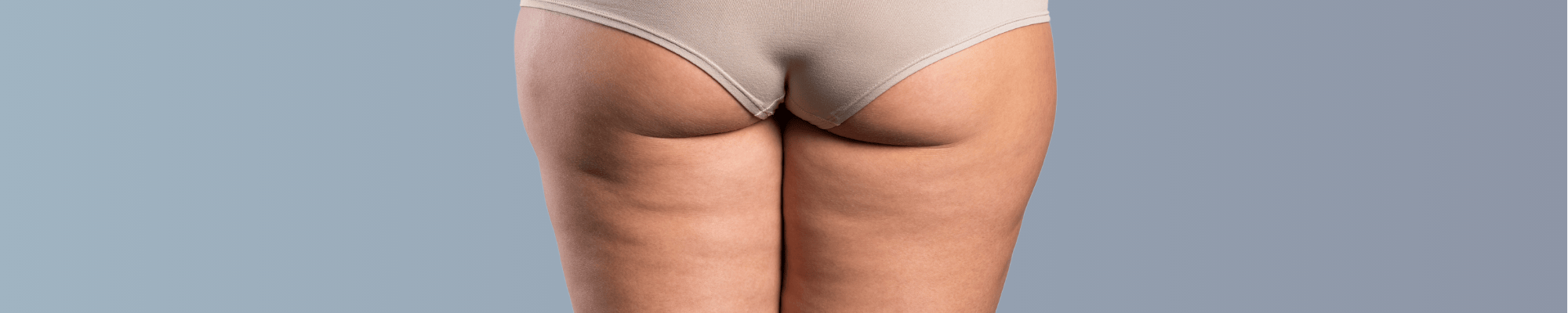Cellulite loswerden Schwaches Bindegewebe stärken und Orangenhaut straffen