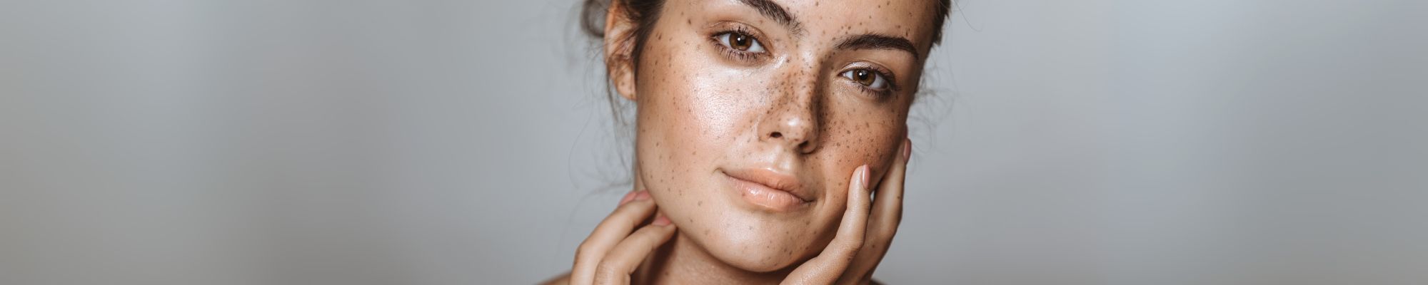 How to get rid of dark spots Remove dark spots, age spots, hyperpigmentation and post-acne marks