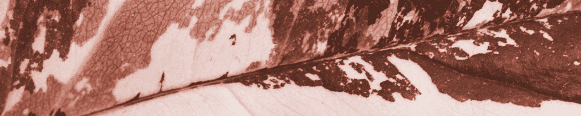 Melasma – Pigmentflecken in der Schwangerschaft Hyperpigmentierung und Melasmen in der Schwangerschaft