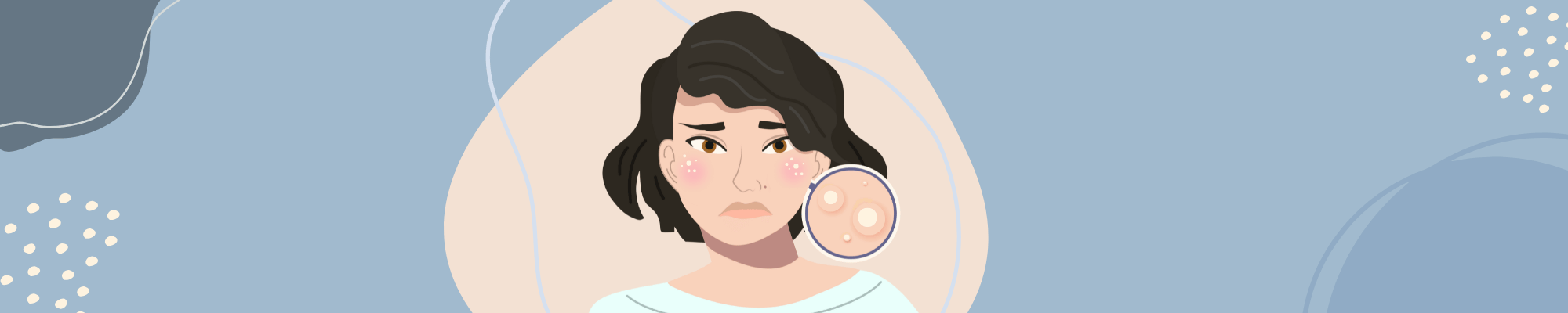 Prevent and Remove Milia What causes milia