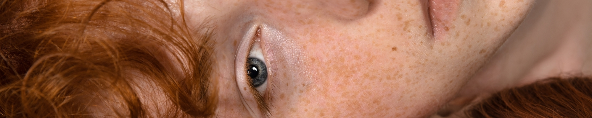 Pigmentstörung – Ursache & Behandlung Die verschiedenen Formen von Pigmentstörungen: Von Hyperpigmentierung bis Vitiligo