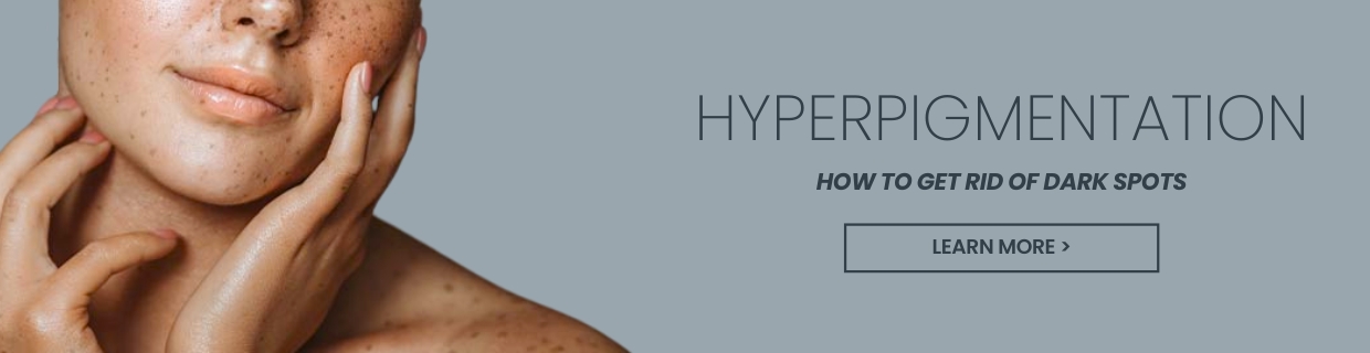  How to remove age spots 