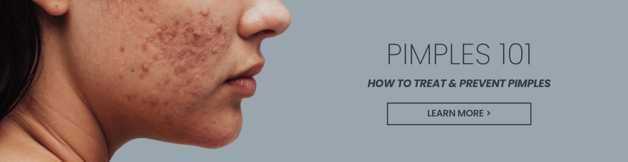 How to get rid of pimples