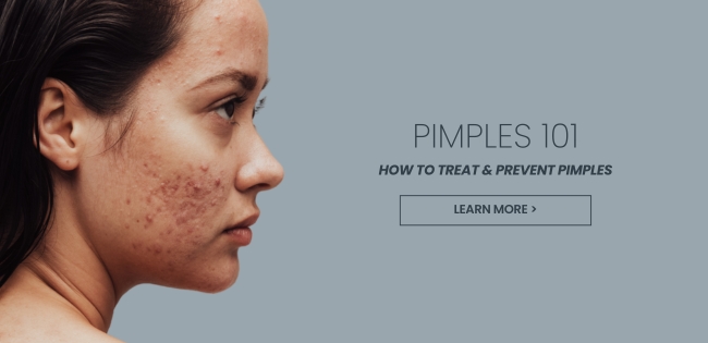 How to get rid of pimples
