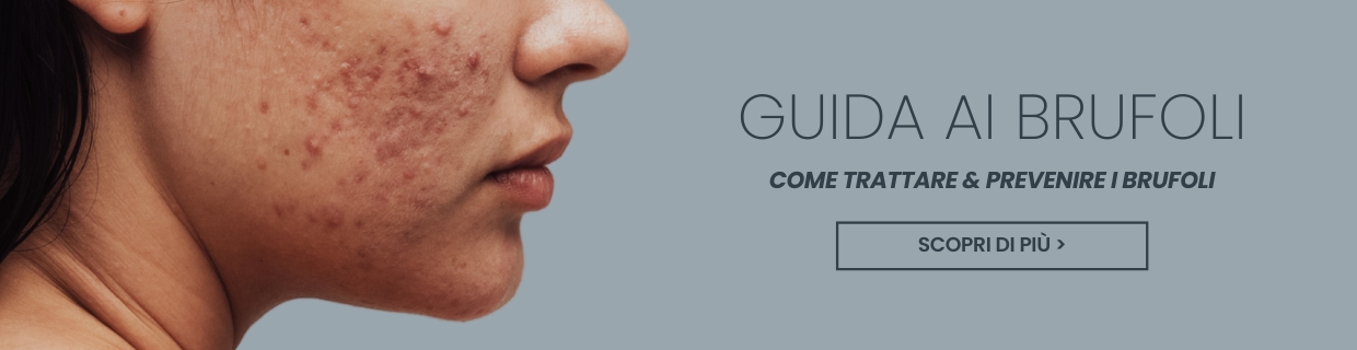 Come trattare e prevenire i brufoli