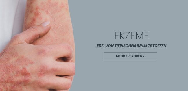 Ekzeme gehÃ¶ren zu den hÃ¤ufigsten Hauterkrankungen