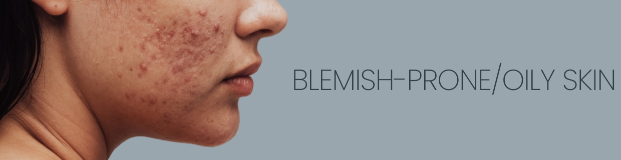 How to get rid of pimples