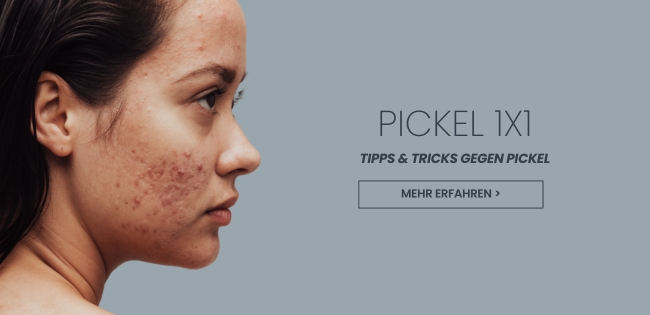 Was hilft gegen Pickel