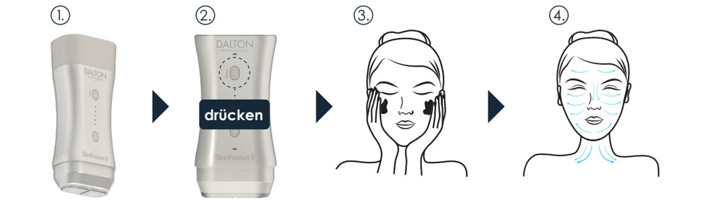 SkinFusion II Anwendung - dritter Behandlungsschritt